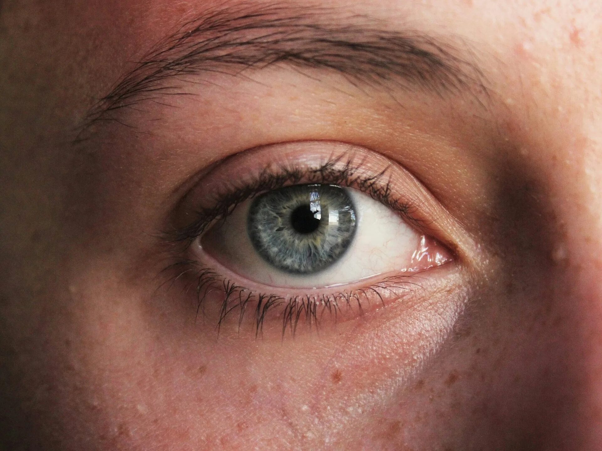 Глаз крупно лицо. Лицо без одного глаза. Широко открытые мужские глаза. Глаз без ресниц. Девушка без глаза фото.