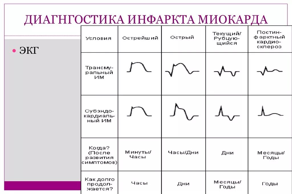 Тест инфаркт миокарда экг