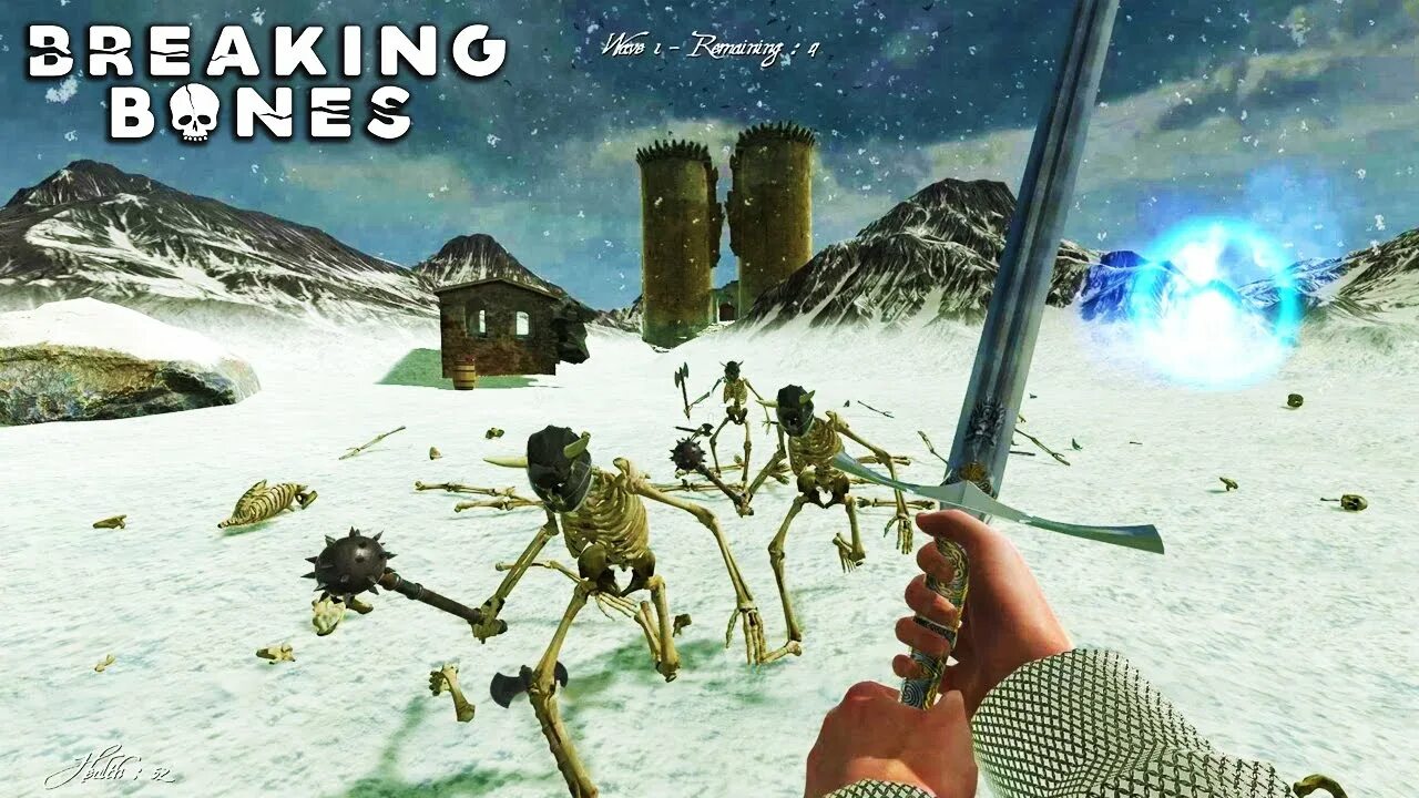 Breaking bones 5. Breaking bones 5. Breaking bones 5. Broken bones brain. Breaking bones 5.