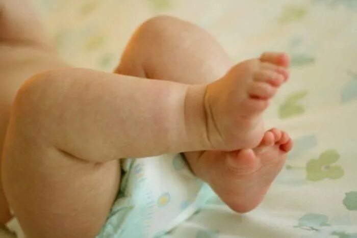 Сухая кожа у ребенка 1 год. Шелушение кожи у новорожденного. Буллезный эксфолиативный дерматит. Аллергическая сыпь на ногах у ребенка. Атопический дерматит причины у детей 4 месяца.