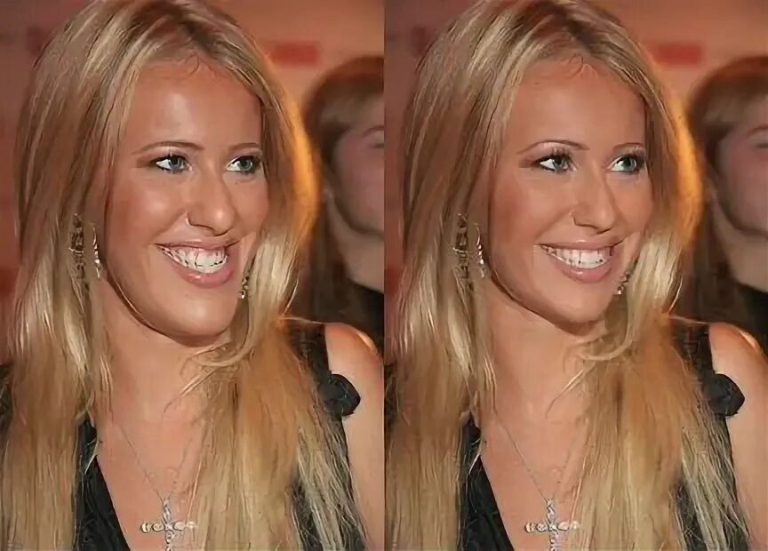 ксения собчак прикус. собчак прикус. собчак прикус. собчак зубы. собчак прикус.