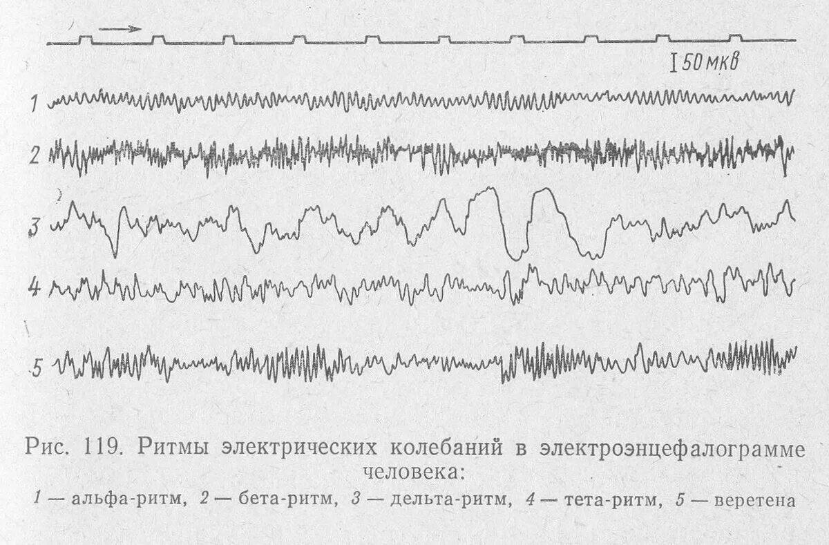 Альфа ритм бета ритм тета ритм Дельта ритм ЭЭГ. Основной ритм ЭЭГ норма. ЭЭГ Альфа бета тета Дельта ритмы. Дельта активность на ЭЭГ У взрослых. Биоэлектрической активности коры головного мозга