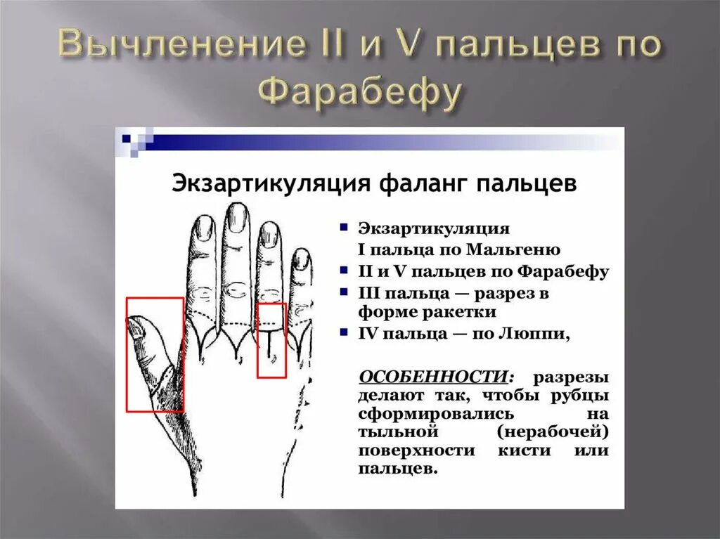 Фаланга пальца. Фаланги пальцев кисти. Первая фаланга среднего пальца.