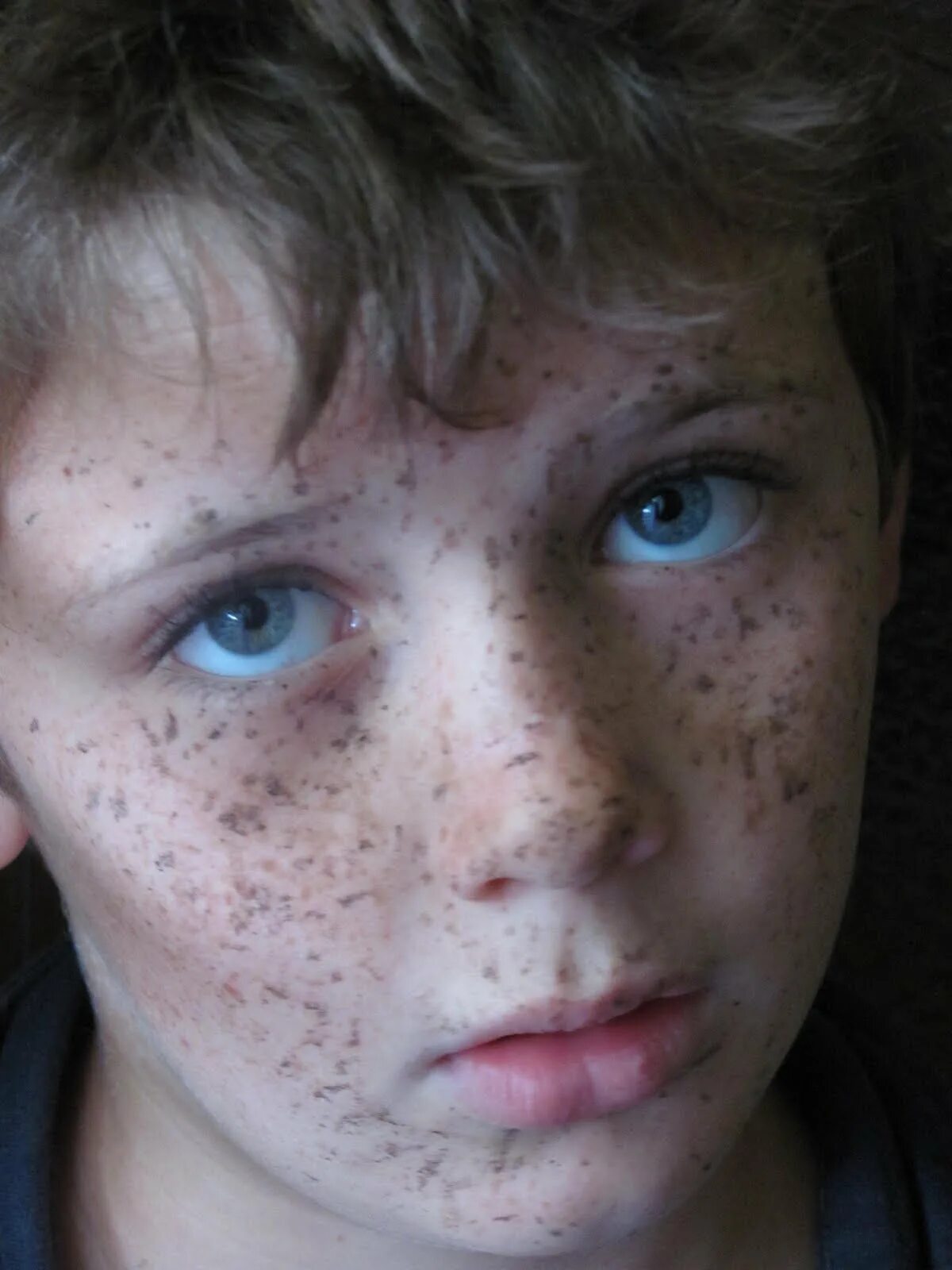 Freckles перевод. Boy with Freckles. Girl with a lot of Freckles.