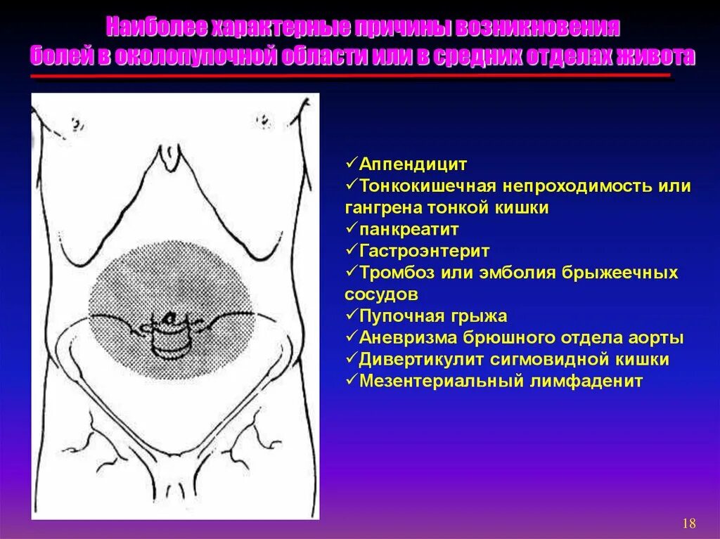 Околопупочная боль в животе. Околопупочная область. Пальпация пупочного кольца. Пульсация в околопупочной области. Пальпация тонкого кишечника.