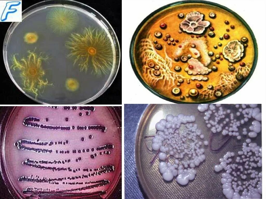 Клонирование бактерий. Бактерии гниения. Культивирование чумного микроба. Серийные разведения микроорганизмов.