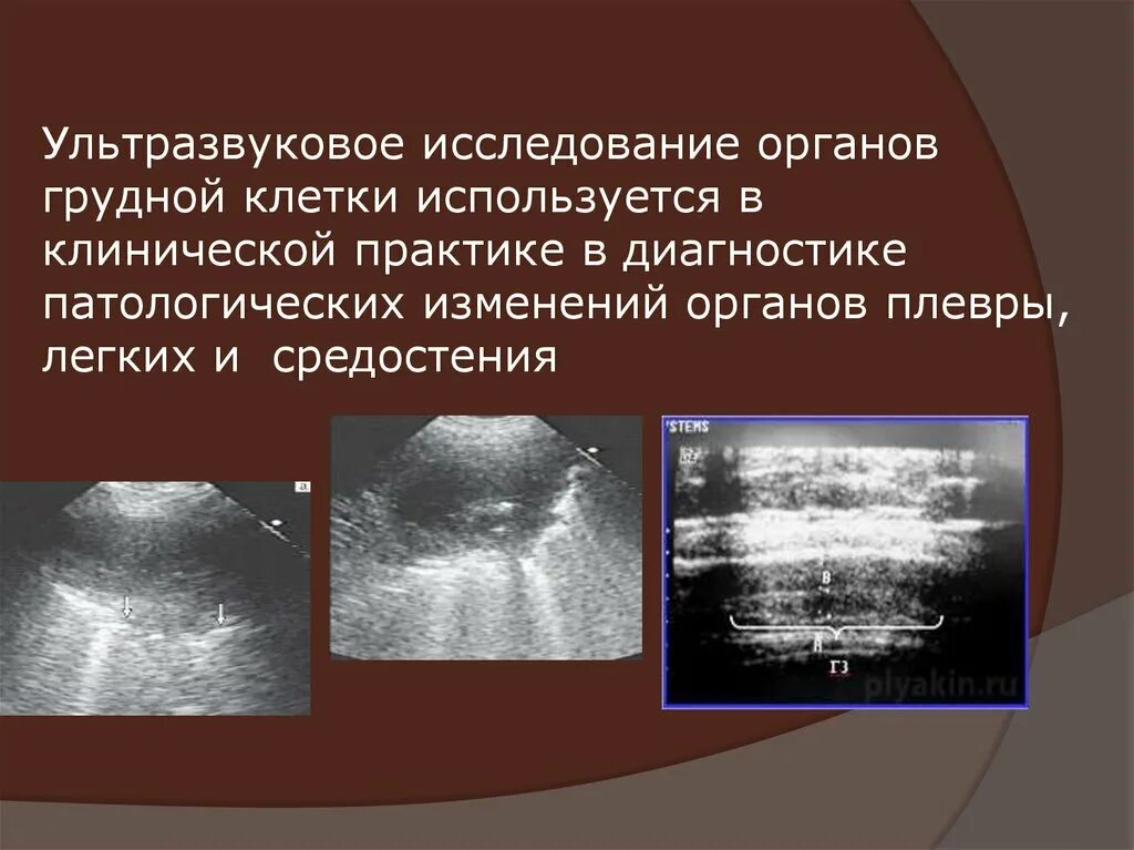 Узи полные органов. Ультразвуковое исследование. Ультразвуковое исследование органов. УЗИ исследование. УЗИ органов грудной клетки.