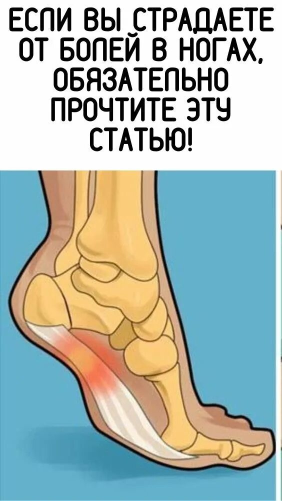 Очень сильно болят стопы. Ballet stopa.