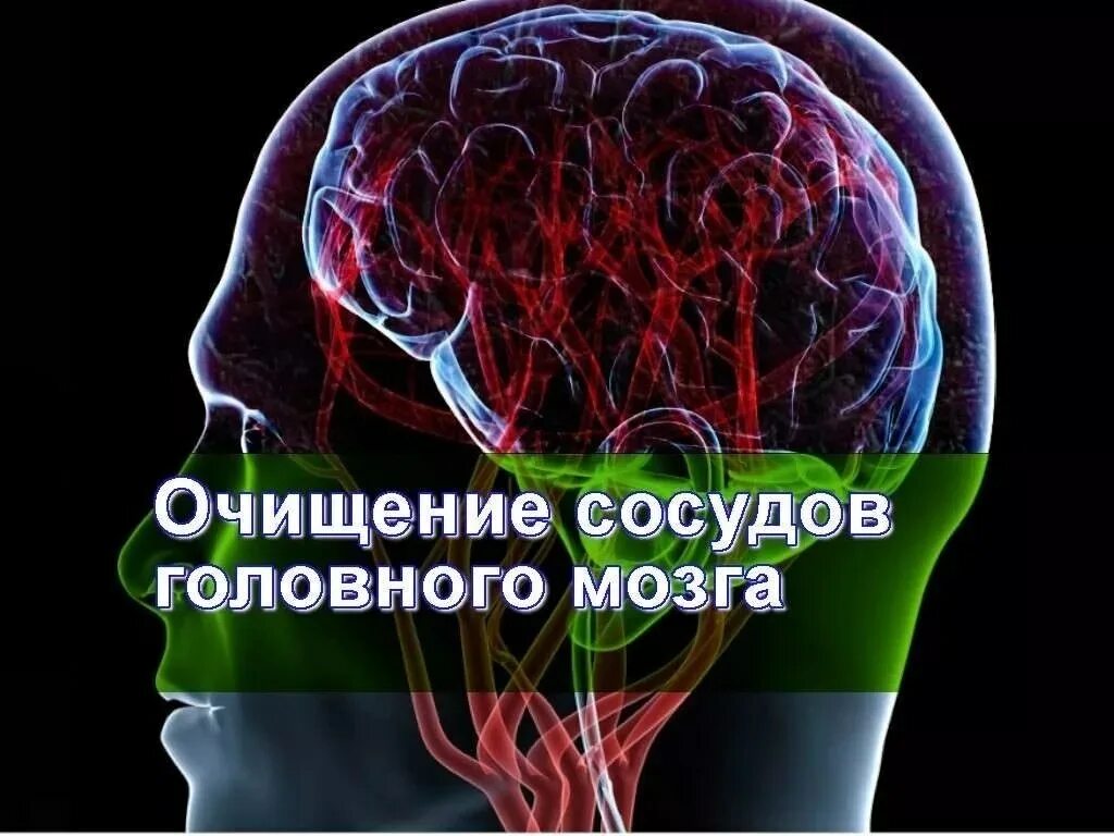 Что чистит мозг. Очищение сосудов головного. Чистка сосудов головного мозга. Средства для чистки сосудов головного мозга.