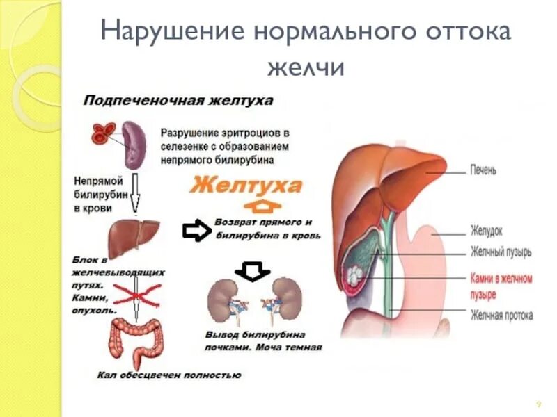 Отток желчи. Нарушение оттока желчи симптомы. Причины нарушения оттока желчи.