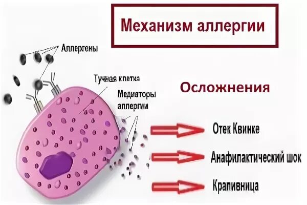 Механизм аллергии. Осложнения аллергозов. Осложнения аллергических реакций. Осложнения аллергии