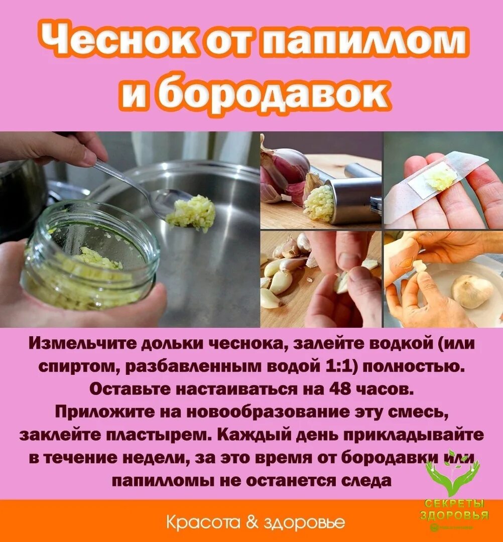 Чеснок от бородавок. Чеснок от бородавок. Сок чеснока от бородавки. Вывести бородавку чесноком. Народные методы избавления от бородавок.