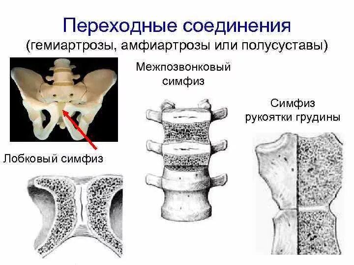 Полусуставы соединения костей. Полусуставы симфизы соединение костей. Лобковый симфиз соединение костей. Симфиз рукоятки грудины.