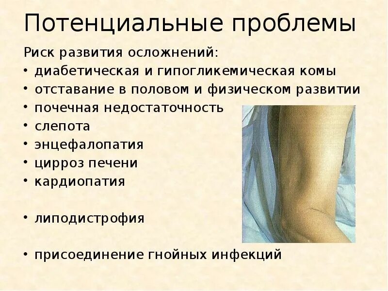 Потенциальные проблемы. Сестринский процесс при заболеваниях эндокринной системы у детей. Потенциальные проблемы со здоровьем. Потенциальные проблемы при сахарном диабете у детей. Хорошо осложнение