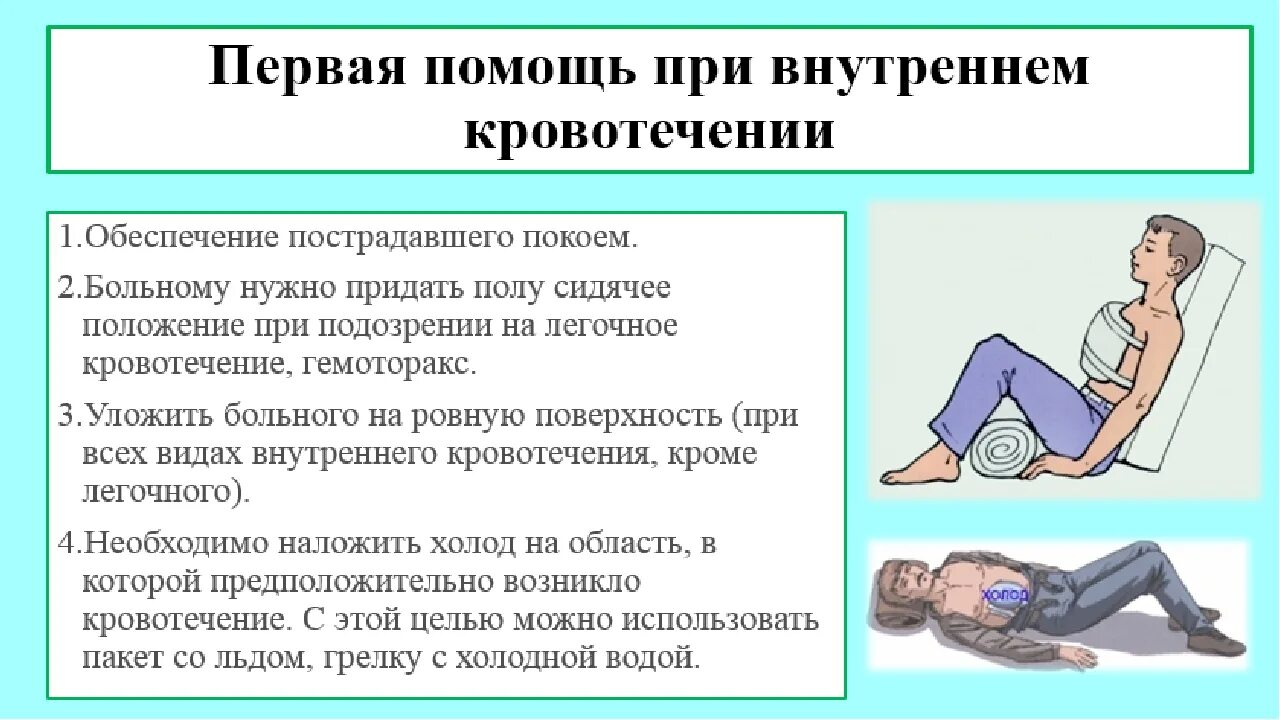 Кровотечение какие симптомы. Оказание первой помощи при внутреннем кровотечении. Первая помощь при внутреннем кровотечении. Внутреннее кровотечение признаки и первая помощь. Первая помочь внутренегокровотечения.