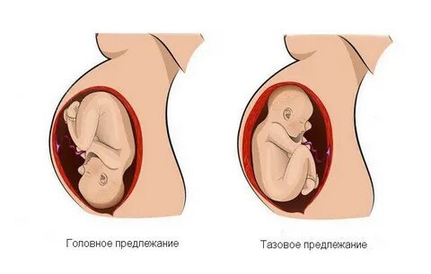 Головное предлежание недели