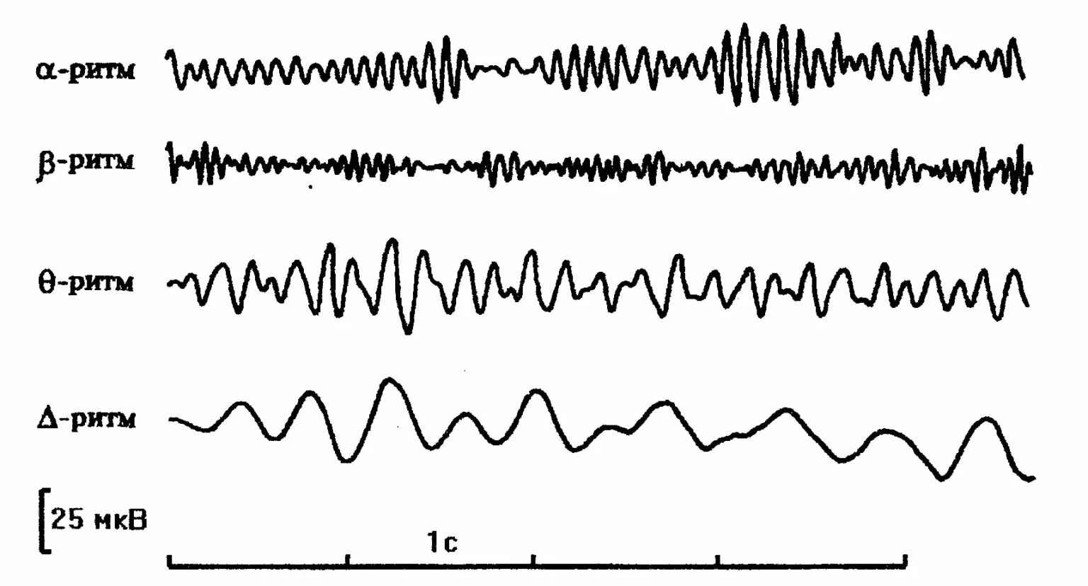 Альфа ритм ЭЭГ. Ритмы ЭЭГ график. Амплитуда Альфа-ритма ЭЭГ. Дельта ритм ЭЭГ.