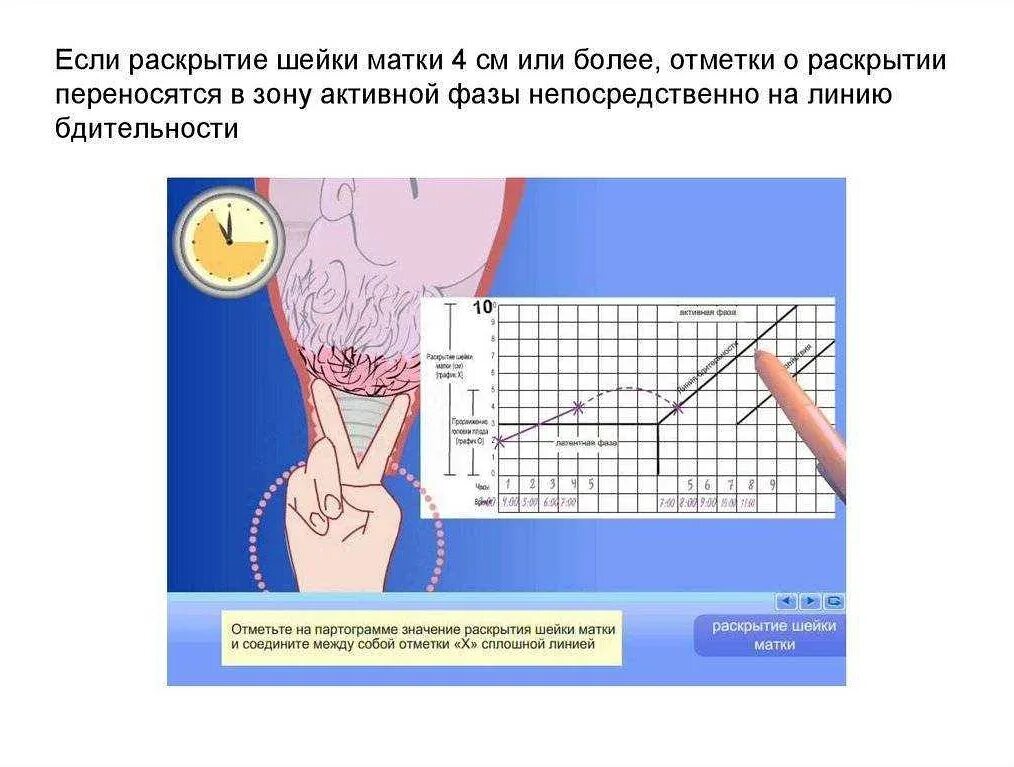 Узнать ип или нет. Раскрытие шейки матки. Проверка порта. Проверить открытые порты. Раскрытие шейной матки.