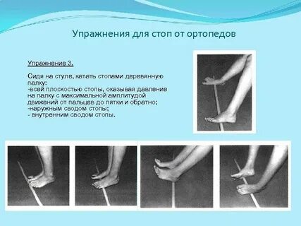Гимнастика для стоп при вальгусной деформации