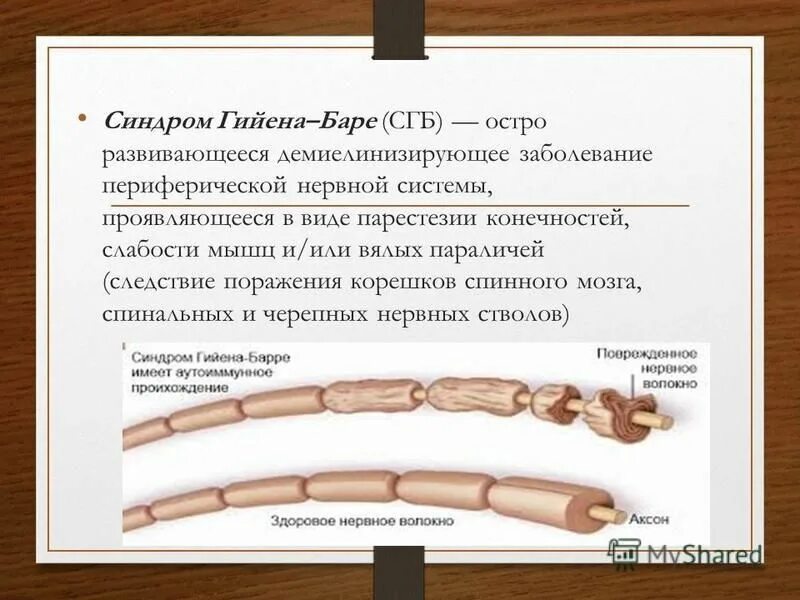 Полинейропатии Гийена Барре. Сенсорный синдром Гийена Барре. Гиена баре заболевание.