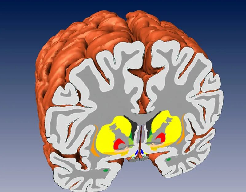 7 3 brain. Строение головного мозга 3д.