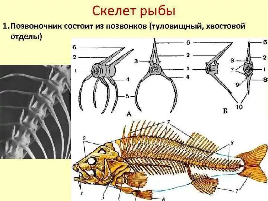 Осевой скелет костных рыб. Осевой скелет речного окуня. Строение позвоночника костных рыб. Строение позвонка костистой рыбы.