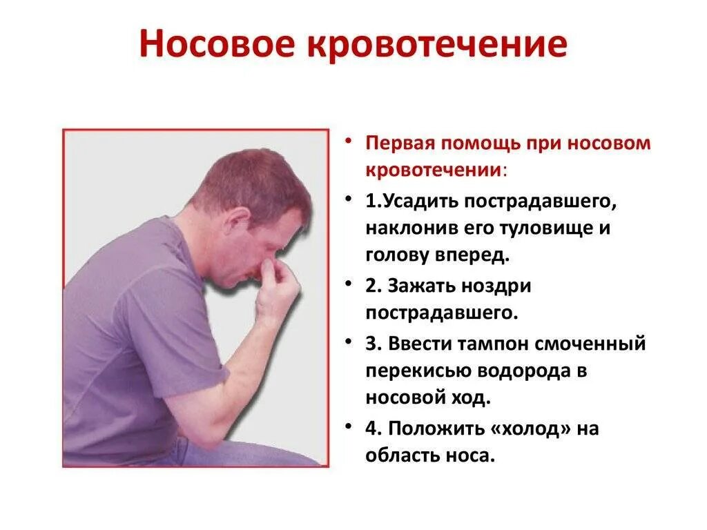 Если носовое кровотечение сопровождается. Симптомы нового кровотечения. Признаки носового кровотечения. Причины носового кровотечения. Причины кровотечения из носа.