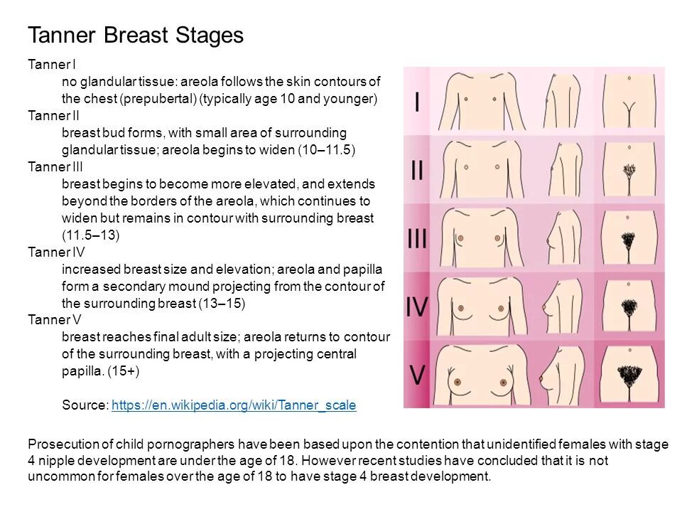 В каком возрасте начинают расти волосы. Стадии полового развития девочек. Этапы развития груди. Этапы роста груди. Развитие женской груди.