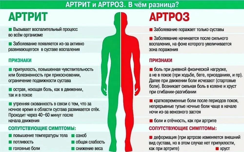 Чем отличается артрит от артроза. Использование слабости