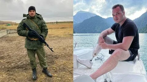 Правда что никите малинину ампутировали ногу