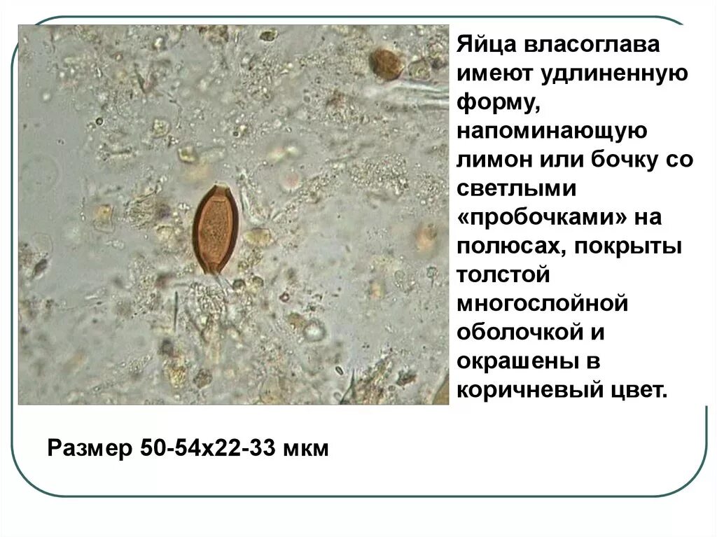 Имеет удлиненную форму в. Яйца власоглава препарат под микроскопом. Власоглав человеческий яйца размер. Размер яйца власоглава. Яйца власоглава препарат.