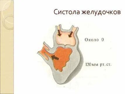 Систола