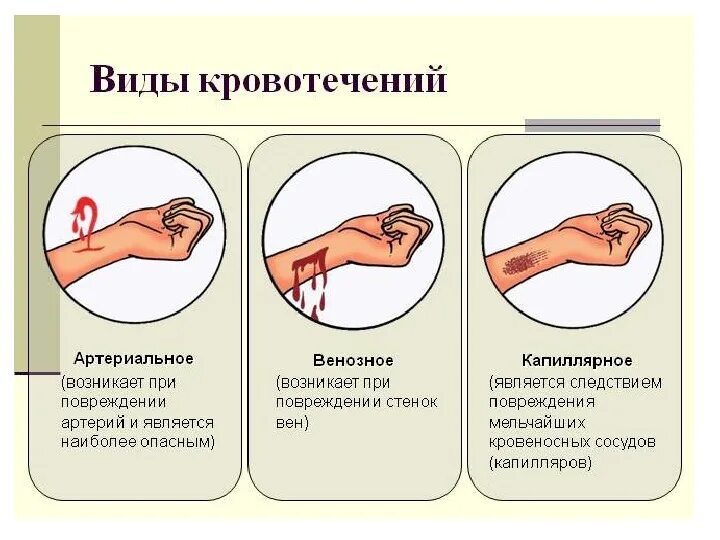 Тест по теме рана
