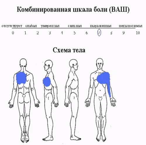 Боль в левой лопатке при движении. Боль под правой и левой лопаткой сзади со спины. болит сзади слева под лопаткой. болит под лопаткой слева сзади со спины. ноющая боль слева под лопаткой сзади со спины.