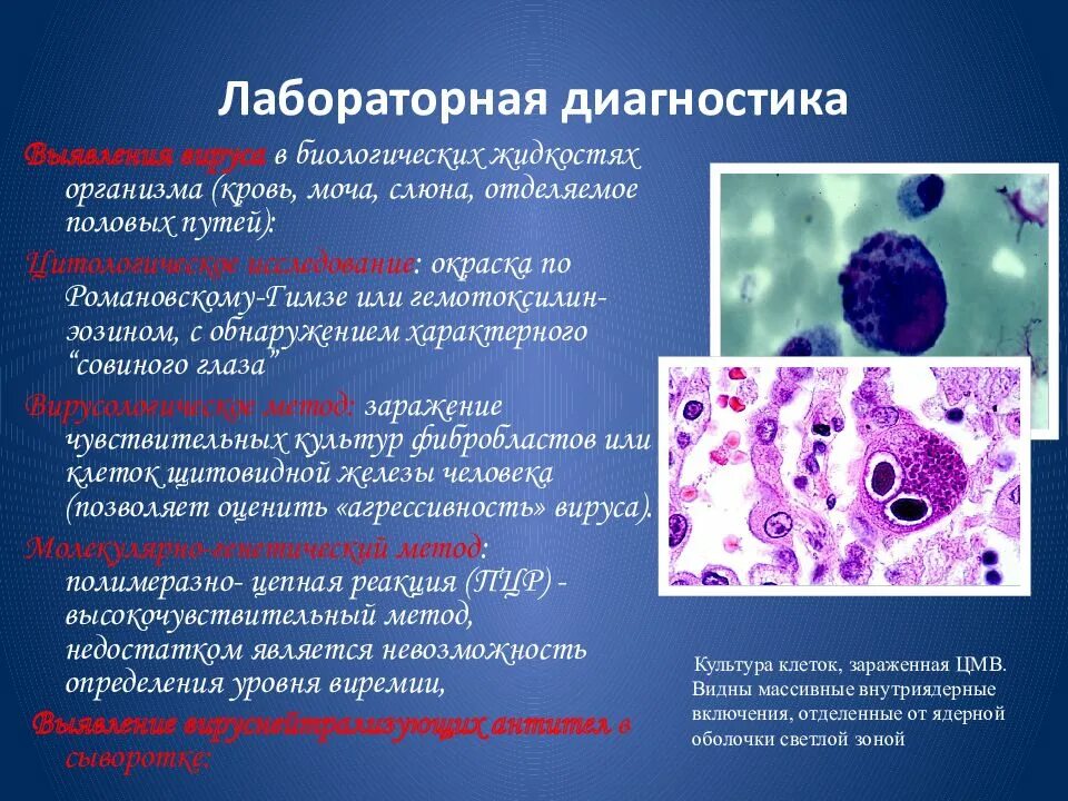 Цмв инфекция что это. Цитомегаловирус микробиология заболевание. Цитомегаловирус инфекция патологическая анатомия. Совиный глаз цитомегаловирус. Цитомегаловирус презентация.