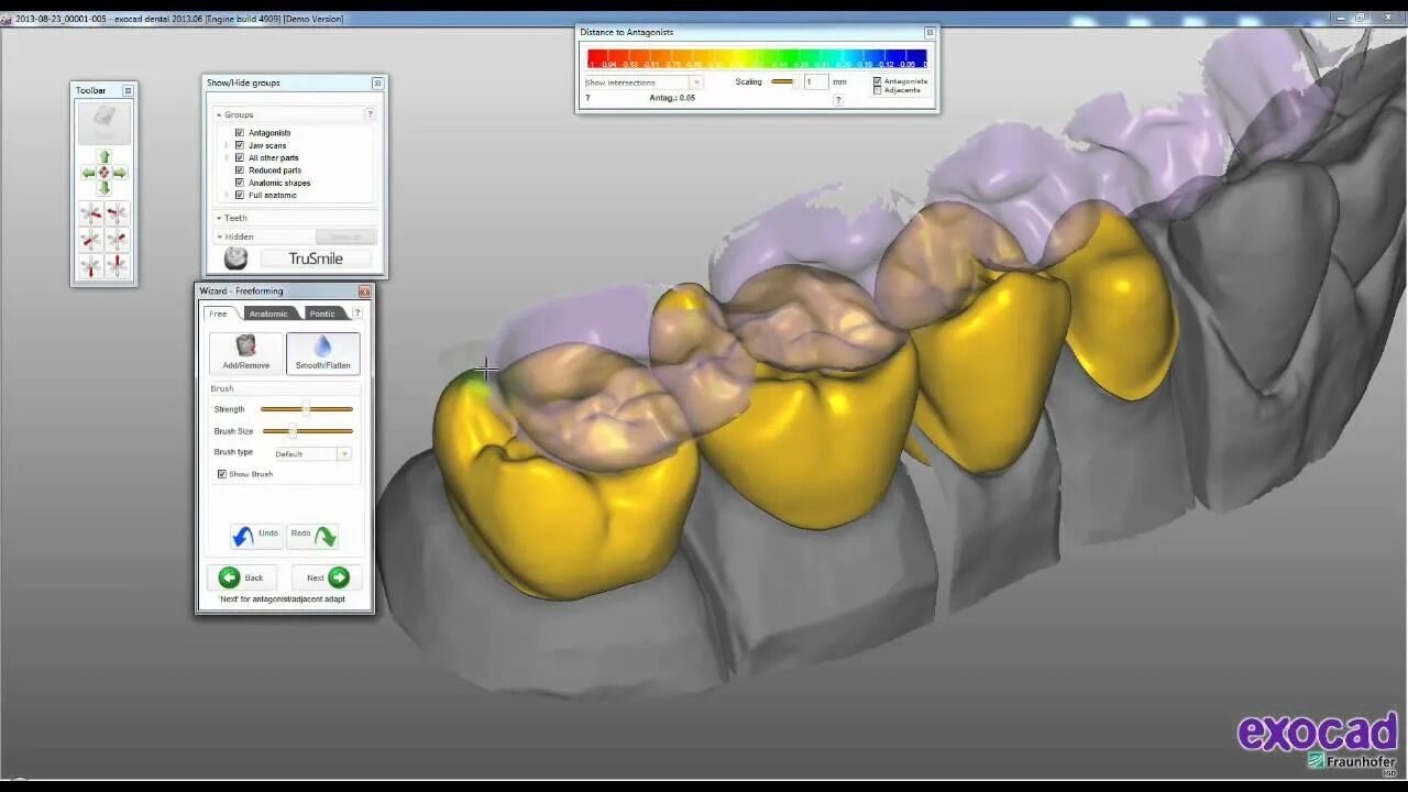 Cad cam моделирование. Cad/cam моделирование exocad. программа exocad для стоматологов.