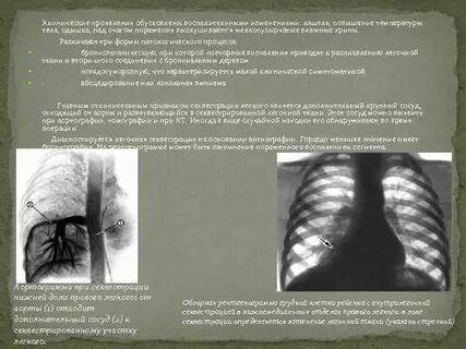 Пороки бронхолегочной системы