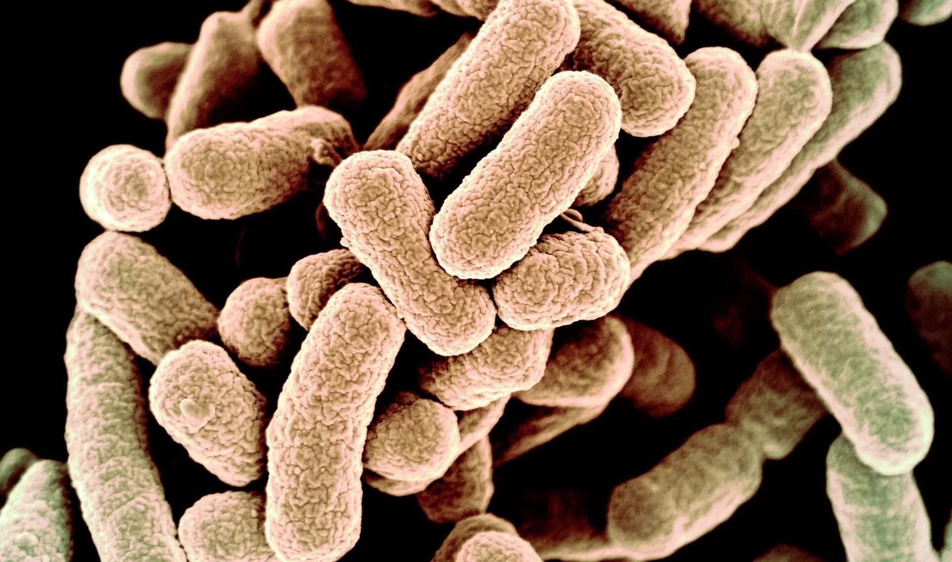 Бактерия Escherichia coli. Кишечная палочка микрофотография. Кишечная палочка Escherichia coli. Бактерия Escherichia coli под микроскопом. Кишечные палочки какая группа