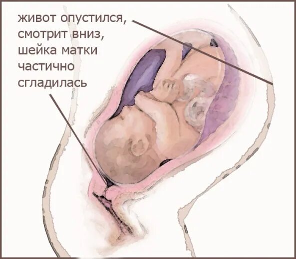 37 недель опустился. Опустившийся живот перед родами. Опущение дна матки перед родами. Как понять что ребенок опустился.