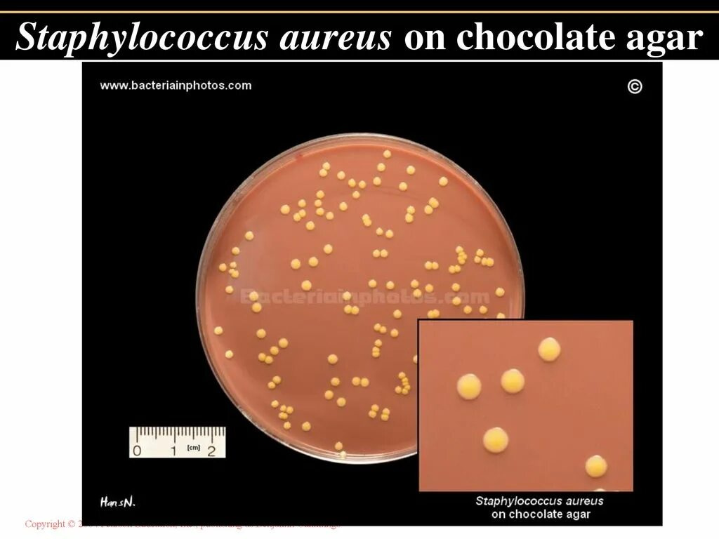 Стафилококк золотистый Staphylococcus aureus. Стафилококки (s. aureus),. Стафилококк ауреус 10.