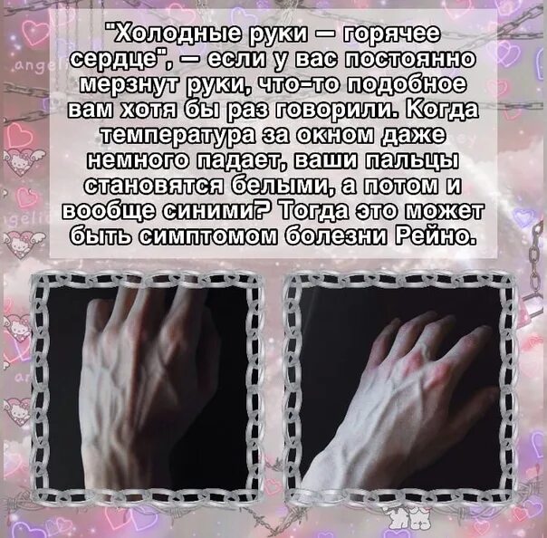 Всегда холодные руки. Холодные руки причины. Почему руки всегда холодные. Почему у человека всегда холодные руки. Почему постоянно ледяные руки.