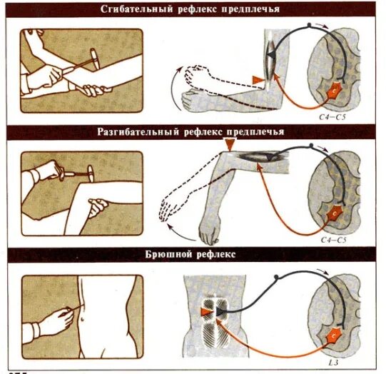 Схема дуги сгибательно-локтевой рефлекс,. Локтевой сгибательный рефлекс физиология. Локтевой сгиьательный реыоекс. Сгибательный рефлекс предплечья физиология. Проверка рефлексов