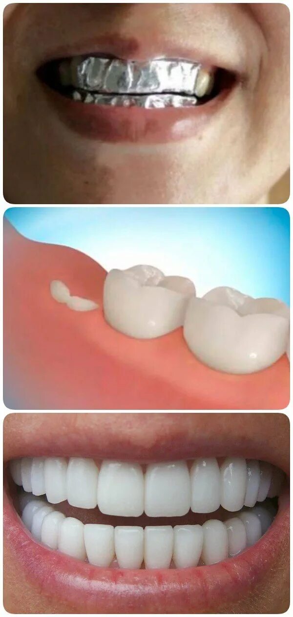 Регенерация зубов в любом возрасте. Как вырастить зубы заново. Как вырастить зубы заново. Как вырастить зубы заново. Как вырастить зубы заново.