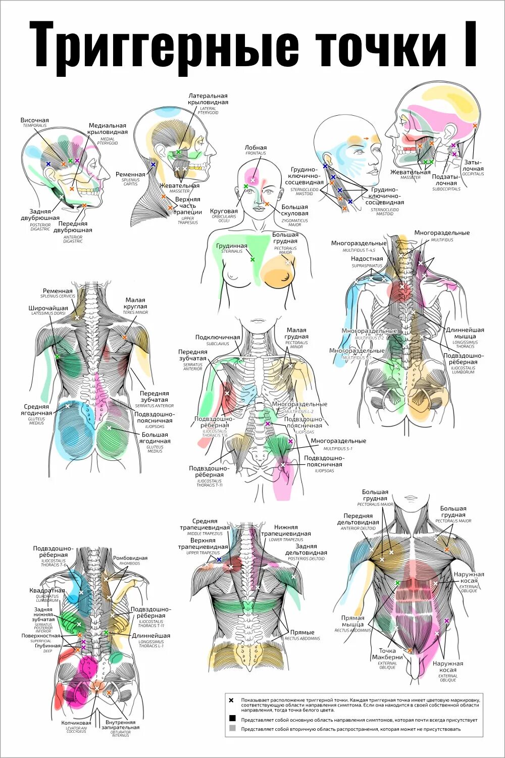 Работа с триггерными точками. Схема триггерных точек на теле. Массаж триггерных точек. Карта триггерных точек спины. Триггерные точки на спине схема.