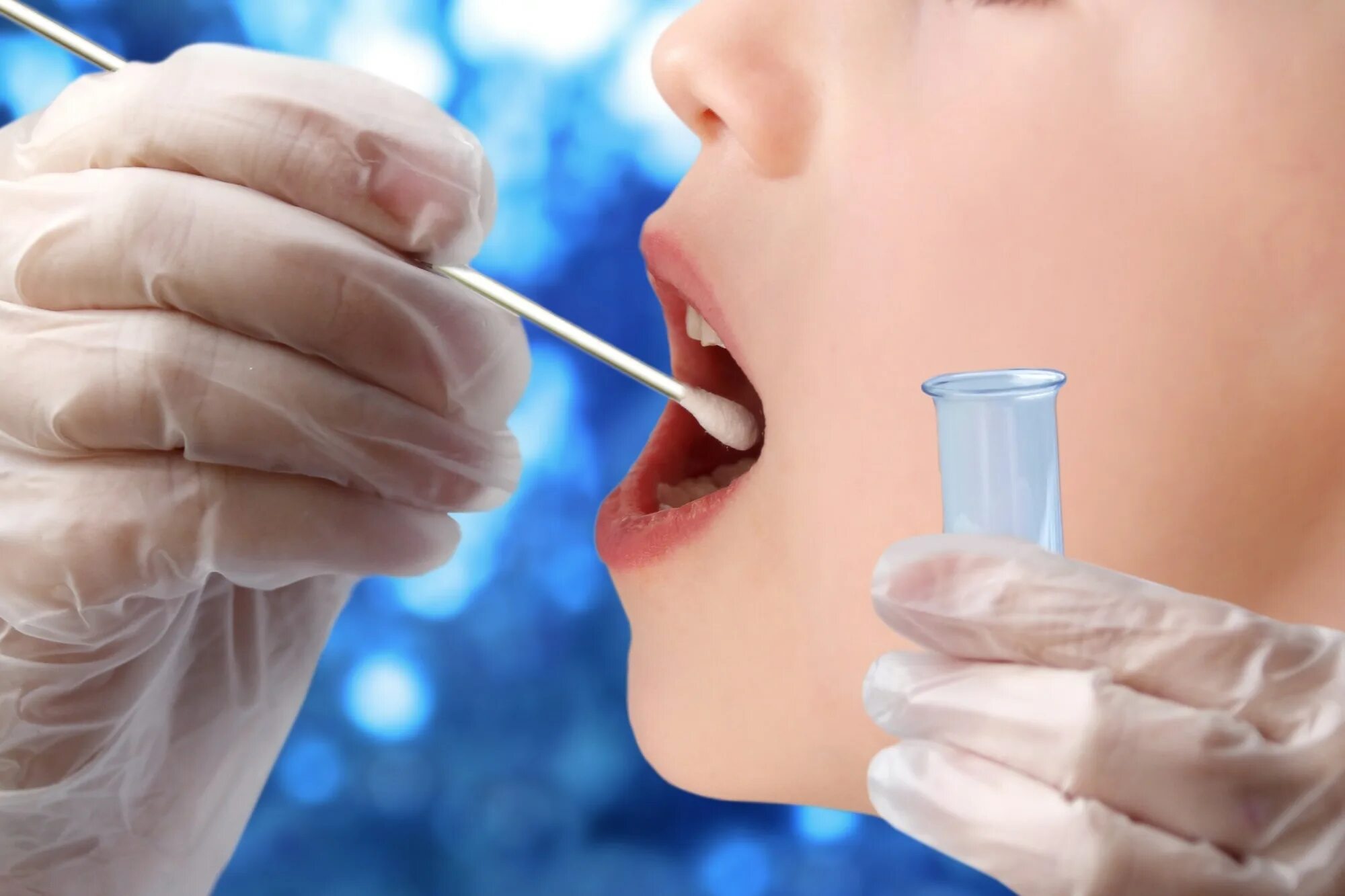 Как называется анализ слюны. Saliva covid test. исследование слюны. исследование ротовой жидкости. сбор слюны.