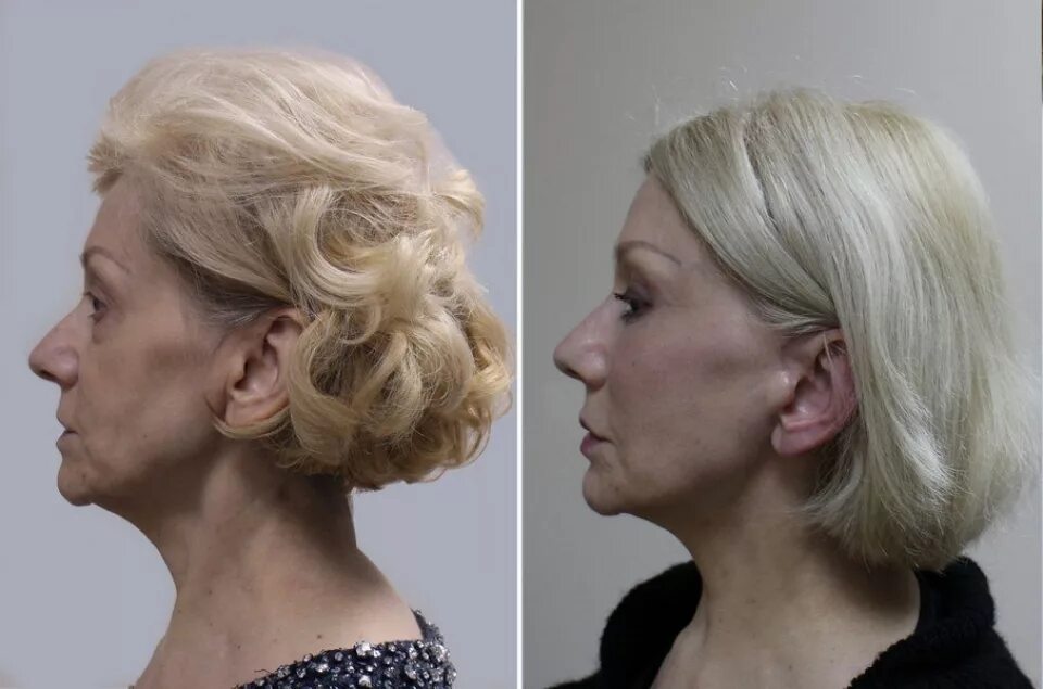 талисов ринат фанильевич. доктор каримов пластический хирург санкт-петербург. каримов рустем фанильевич. кармов ручтам фанильевияь. кармов ручтам фанильевияь.