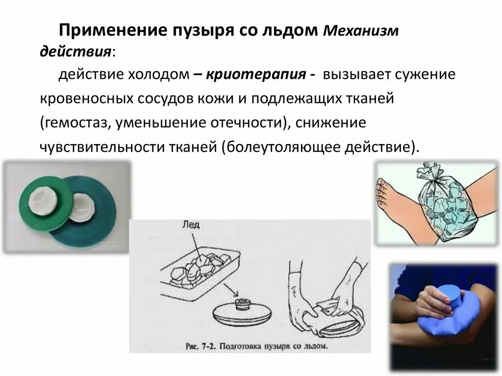 Сколько держать лед после. Грелка и пузырь со льдом алгоритм. Постановка пузыря со льдом памятка. Пузырь со льдом цель показания противопоказания. Постановка пузыря со льдом алгоритм.