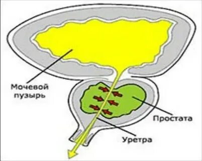 День простаты