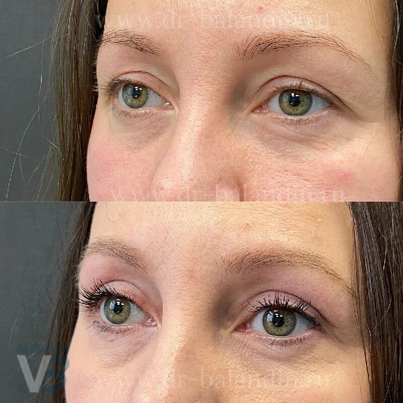 баландин пластический хирург