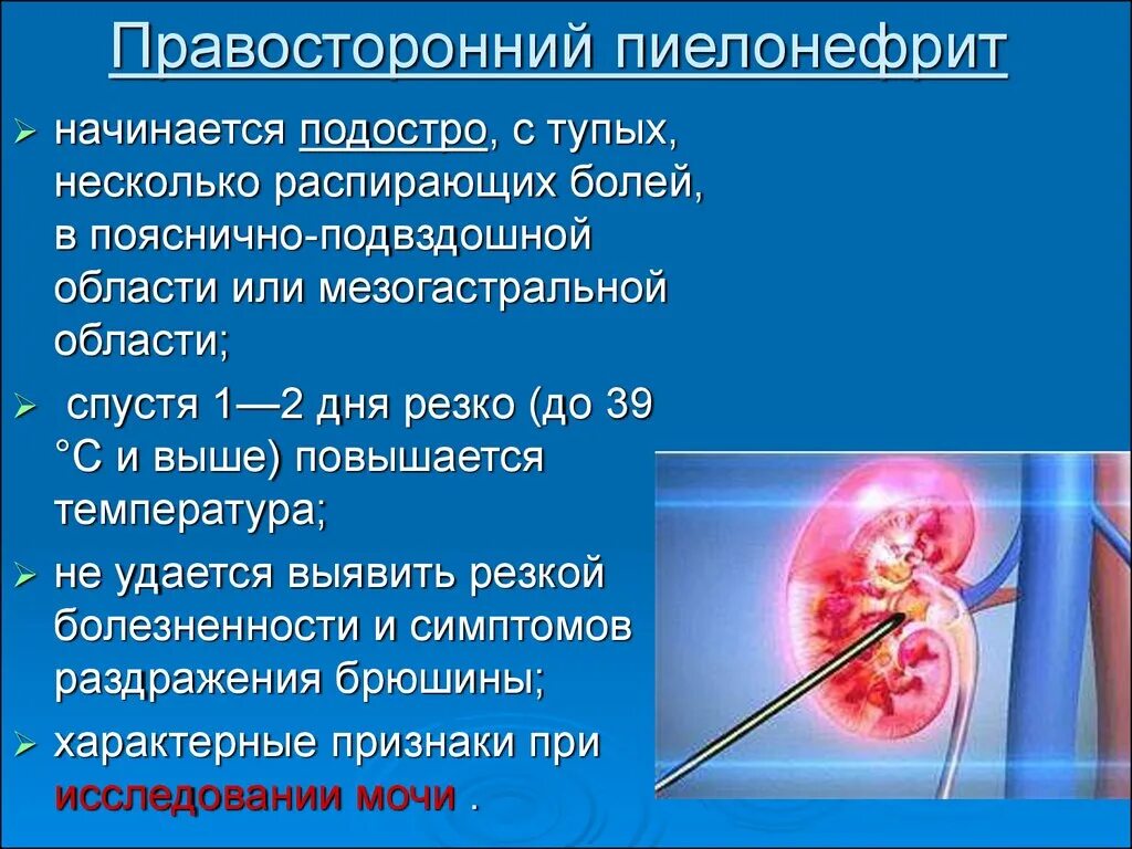 Боль при пиелонефрите